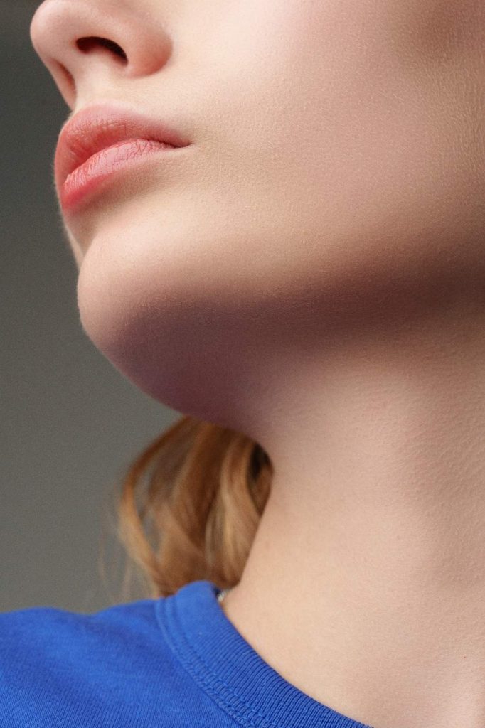 chin fillers gone wrong
