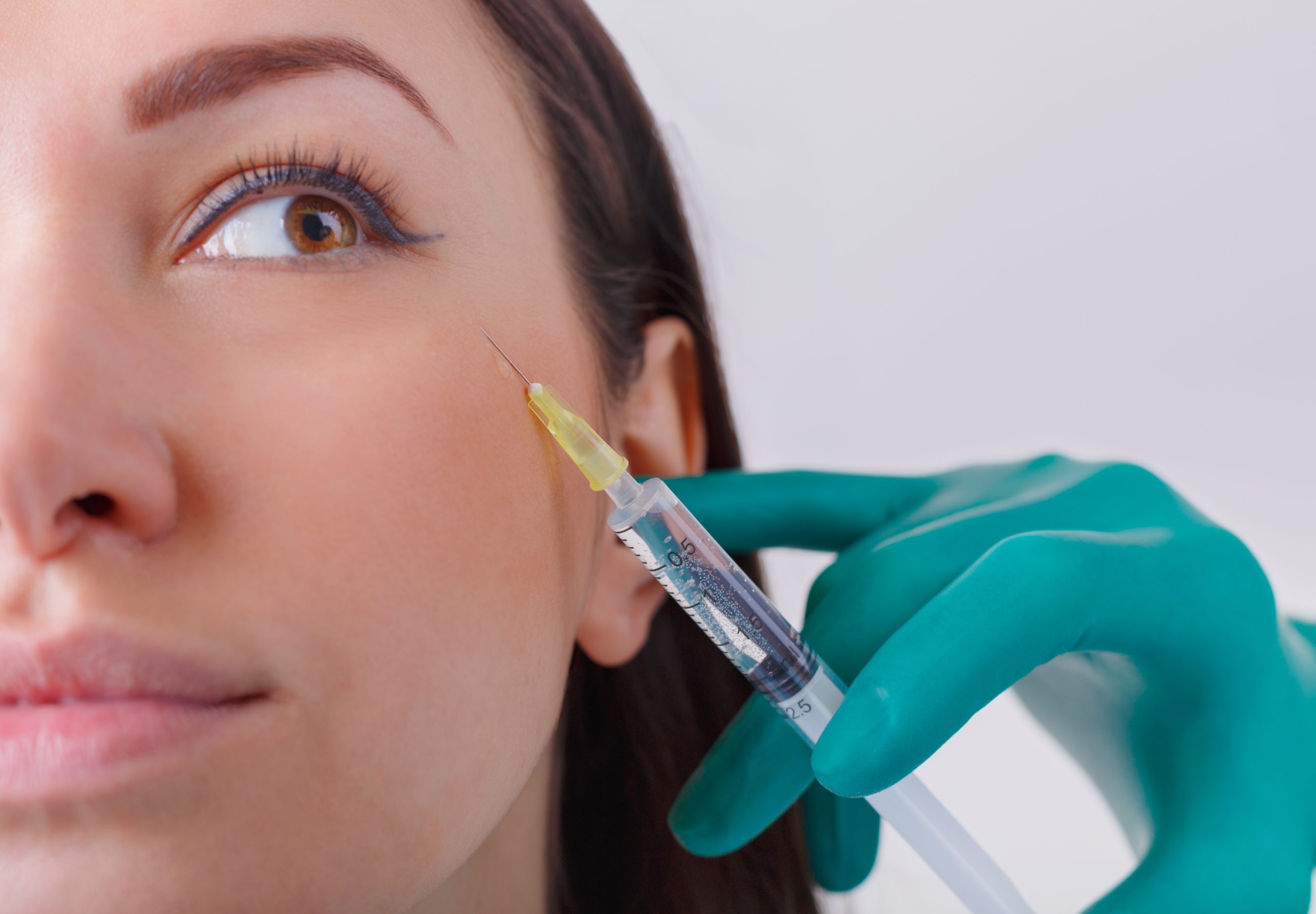 juvederm around eyes