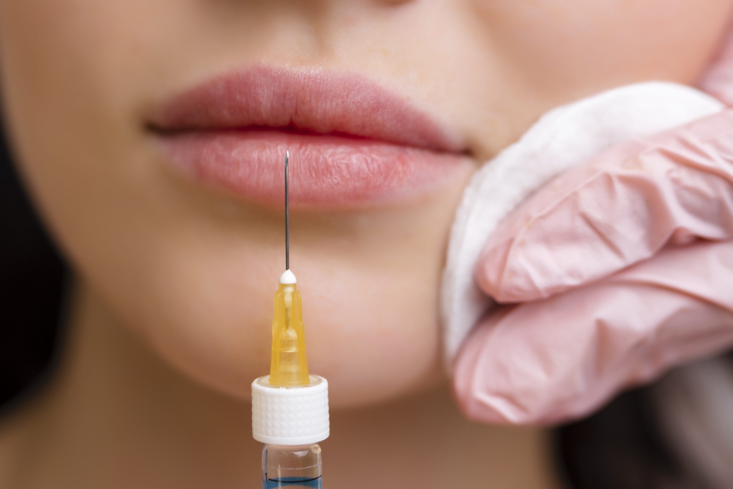 juvederm lip enhancement