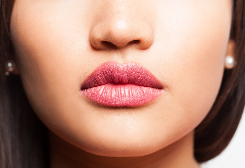 russian lip filler cupid's bow